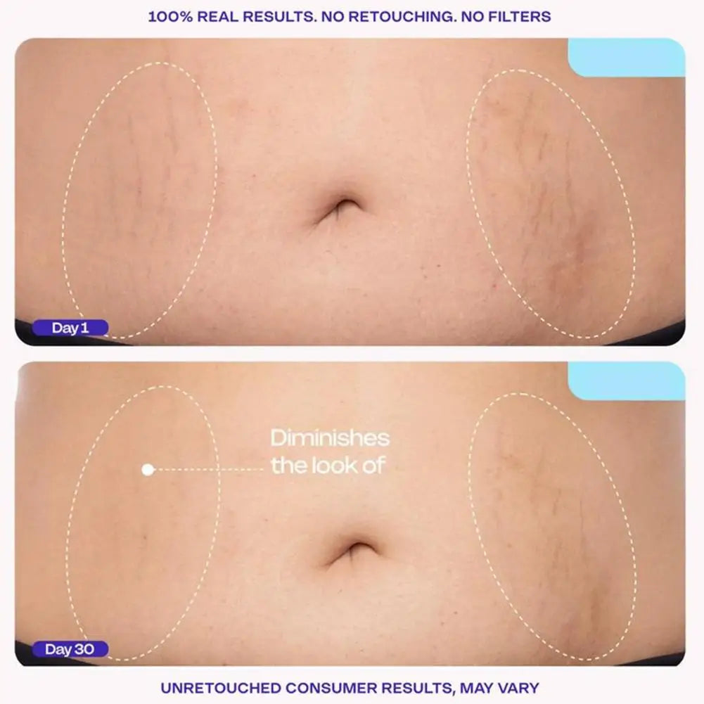 Abdomen Tightening Cream Smooth Abdominal Cream Mild Moisturizer Fast Absorbing Anti-Aging Body Improving Skin Firming Lotion