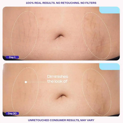 Abdomen Tightening Cream Smooth Abdominal Cream Mild Moisturizer Fast Absorbing Anti-Aging Body Improving Skin Firming Lotion
