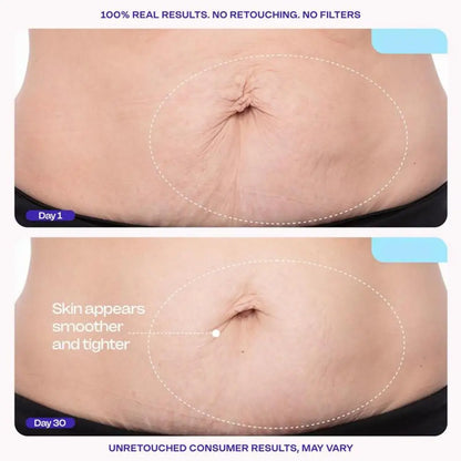 Abdomen Tightening Cream Smooth Abdominal Cream Mild Moisturizer Fast Absorbing Anti-Aging Body Improving Skin Firming Lotion